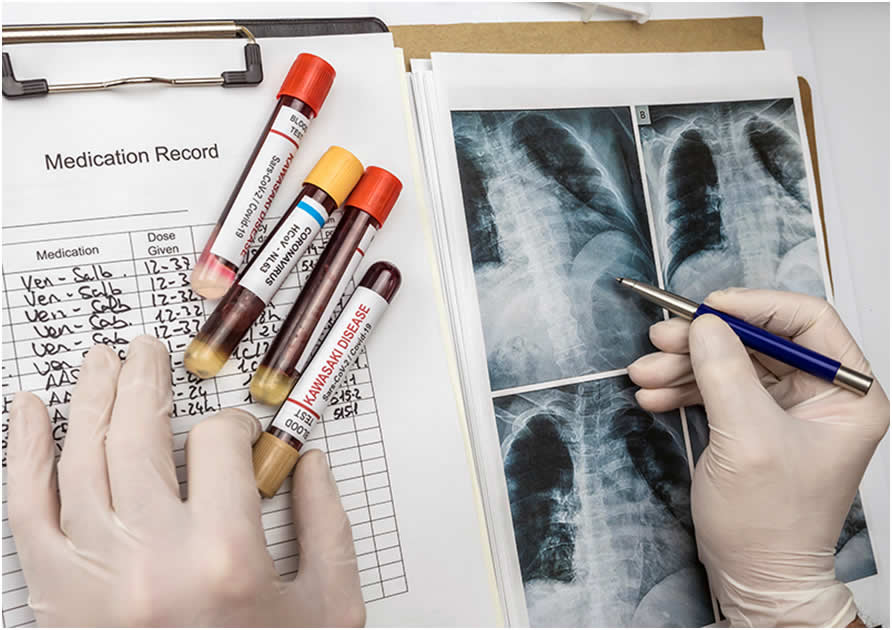 Doença pulmonar obstrutiva crônica – Conheça tudo sobre.