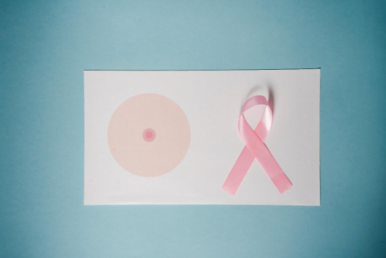Como é a cirurgia para o câncer de mama?